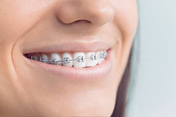 Dental Inlays and Onlays in Decatur, IL
